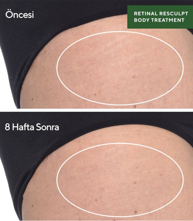 Murad Retinal Resculpt Body Treatment