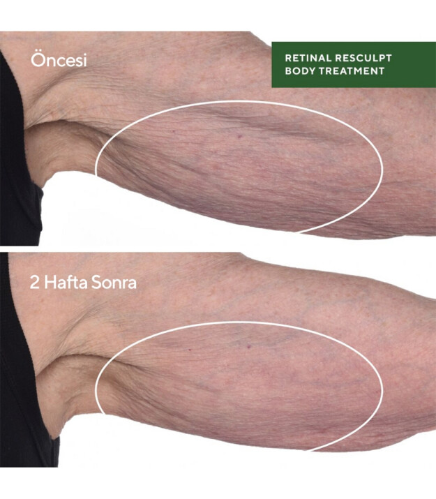 Murad Retinal Resculpt Body Treatment
